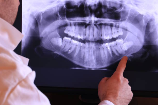 Best 24-Hour Emergency Dental Care in Mclendon Chisholm, TX
