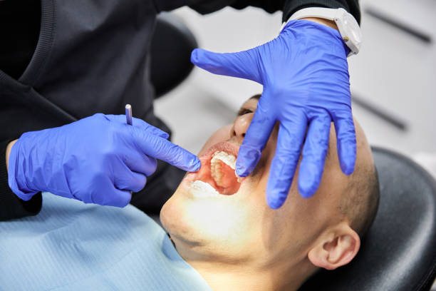 Best Emergency Denture Repair in Mclendon Chisholm, TX